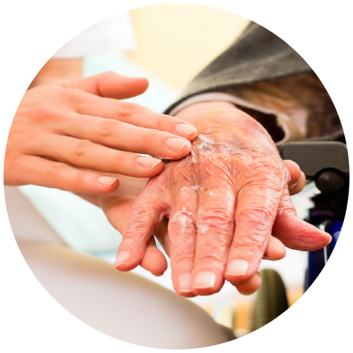 Eine Hand cremt die Hand eines älteren Menschen ein.